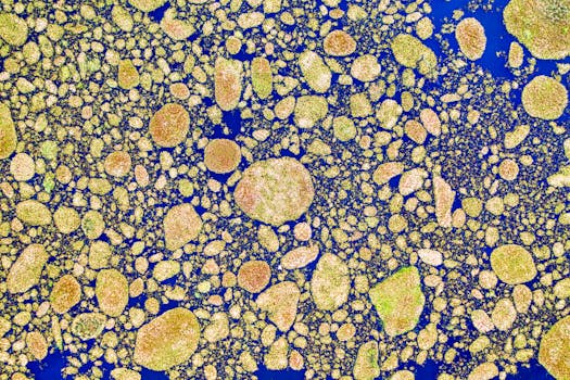 O que é Glycogen storage disease due to liver glycogen phosphorylase deficiency 
